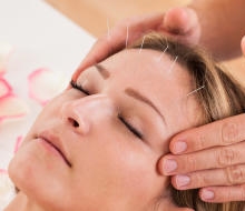 Tratamientos de acupuntura