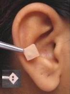 Tratamientos de acupuntura